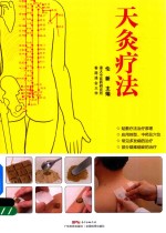 天灸疗法  第2版
