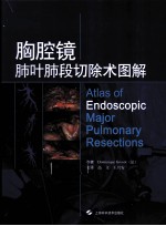胸腔镜肺叶肺段切除术图解