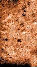 痘疹正宗金鉴  卷1