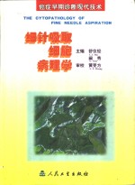细针吸取细胞病理学  癌症早期诊断现代技术