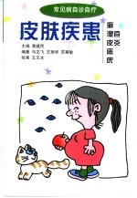 皮肤疾患  癣  湿疹  皮炎  痣  疣