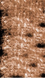 痘科类编释意  卷上