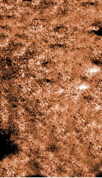 痘疹传新录  卷1-2