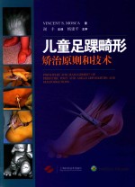 儿童足踝畸形矫治原则和技术